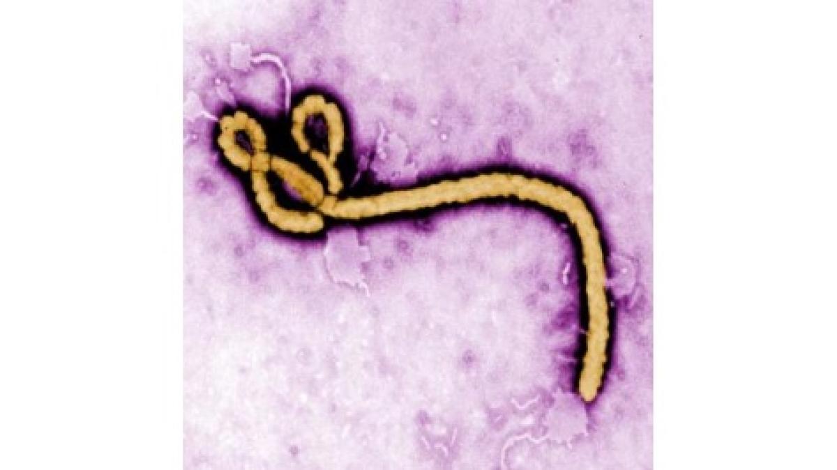 Ebola